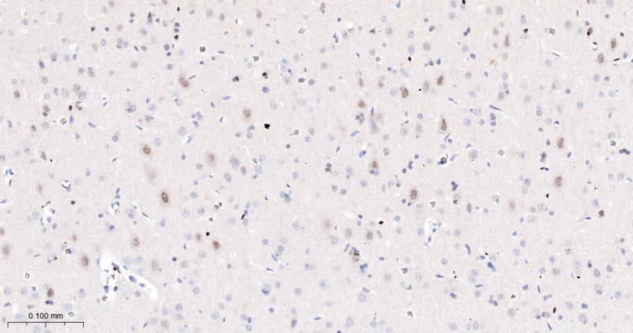 多腺苷二磷酸多聚酶/多聚ADP-核糖聚合酶1重组兔单抗