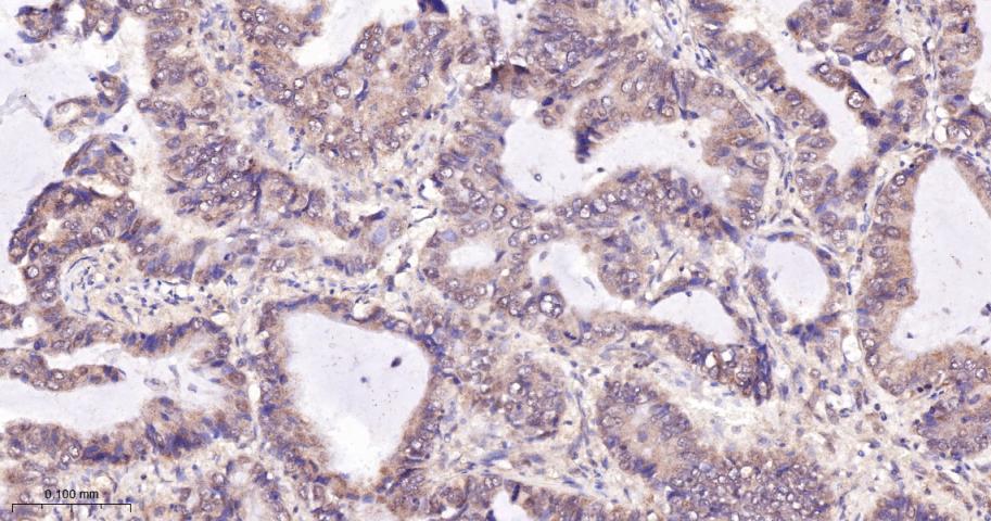 磷酸化原癌基因RAF1重组兔单抗