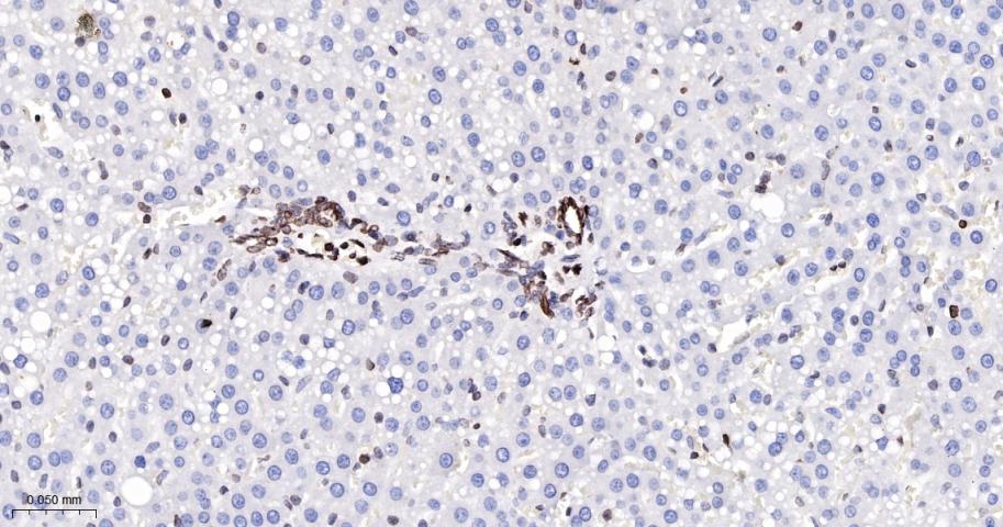 核纤层蛋白B(核内参)重组兔单抗
