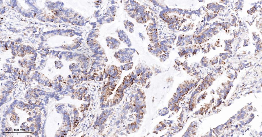 丙酮酸脱氢酶激酶亚型2重组兔单抗