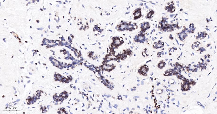 核纤层蛋白B(核内参)重组兔单抗