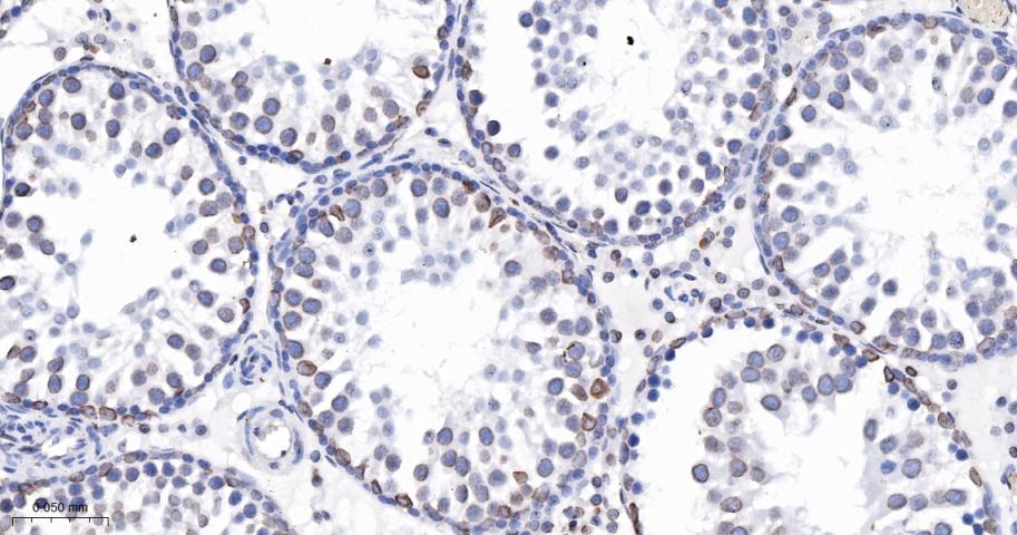 核纤层蛋白B(核内参)重组兔单抗
