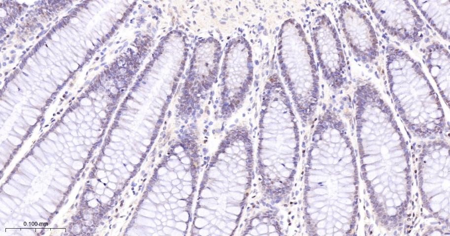 多腺苷二磷酸多聚酶/多聚ADP-核糖聚合酶1重组兔单抗
