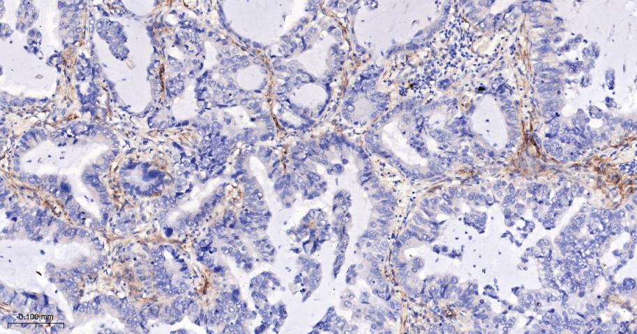 CD276重组兔单抗