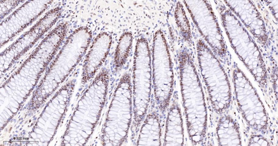 多腺苷二磷酸多聚酶/多聚ADP-核糖聚合酶1重组兔单抗