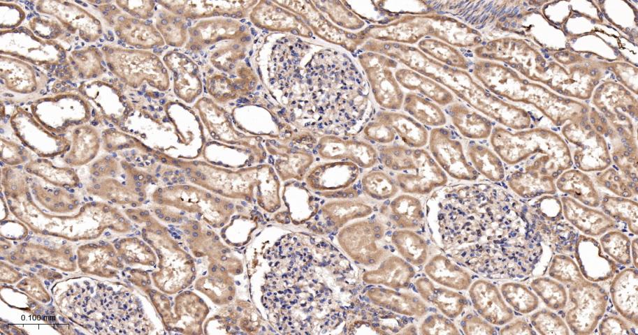 磷酯酶Cβ3重组兔单抗