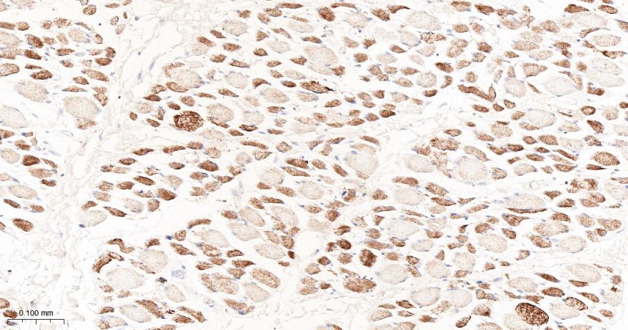 丙酮酸脱氢酶激酶亚型2重组兔单抗