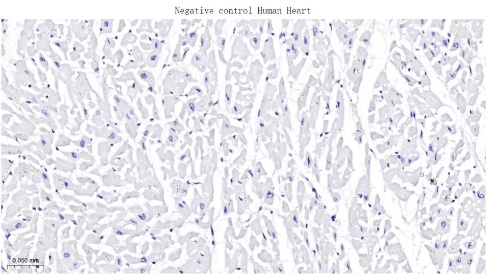 CD276重组兔单抗