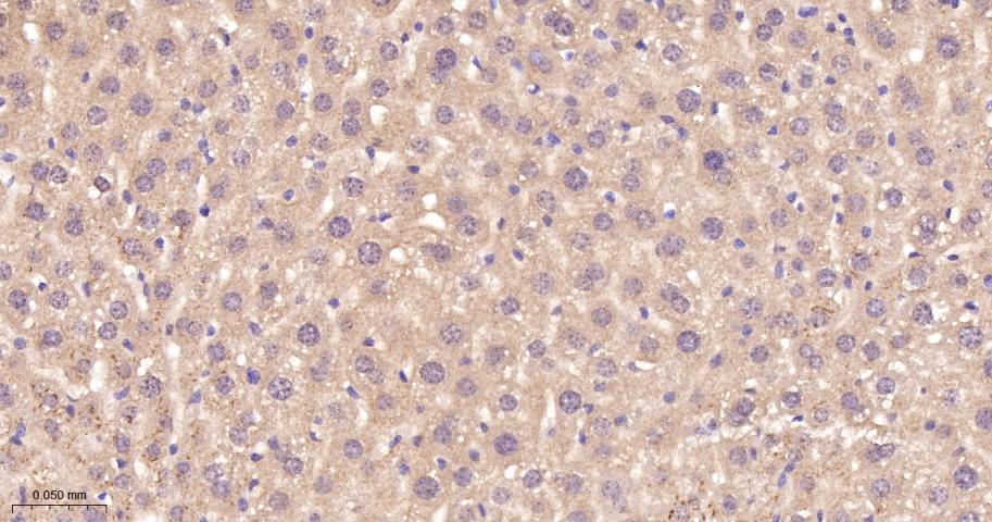 磷酸化原癌基因RAF1重组兔单抗