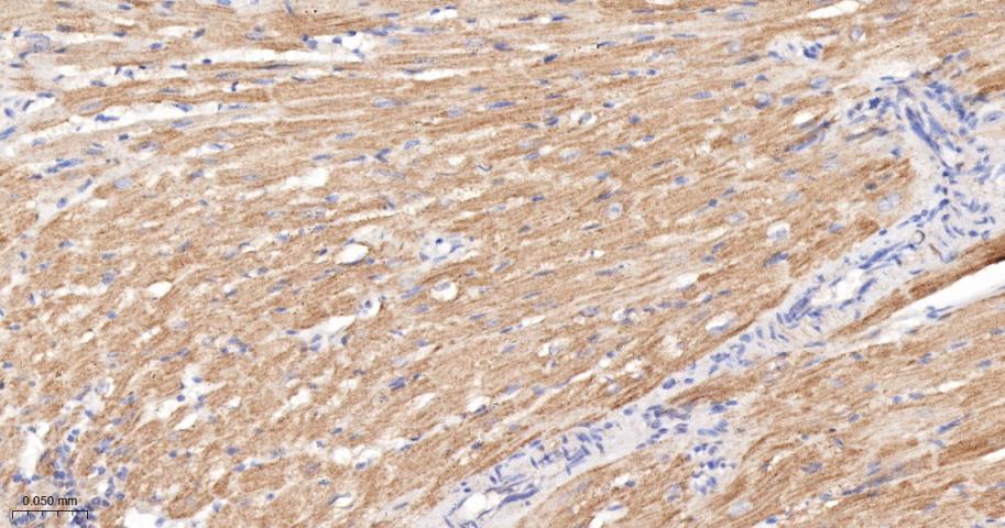 磷酸化原癌基因RAF1重组兔单抗