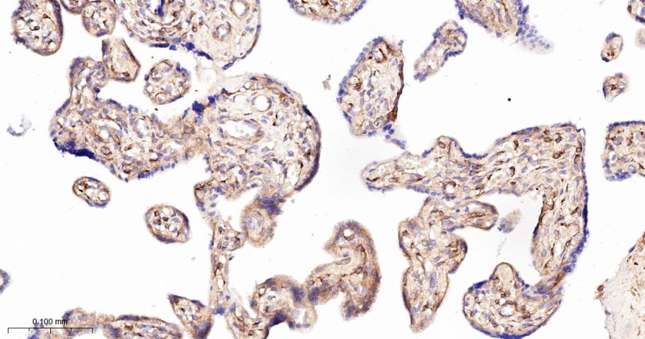 CD276重组兔单抗