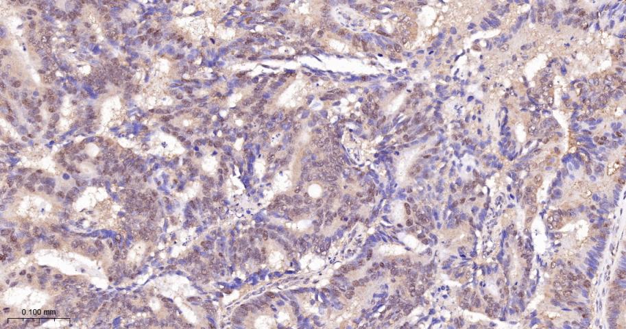 磷酸化原癌基因RAF1重组兔单抗