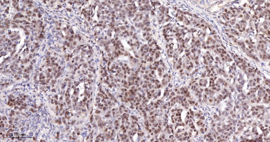 多腺苷二磷酸多聚酶/多聚ADP-核糖聚合酶1重组兔单抗