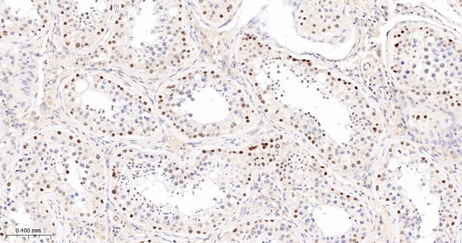 多腺苷二磷酸多聚酶/多聚ADP-核糖聚合酶1重组兔单抗