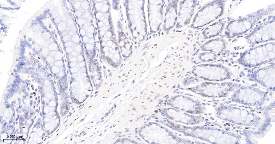 多腺苷二磷酸多聚酶/多聚ADP-核糖聚合酶1重组兔单抗