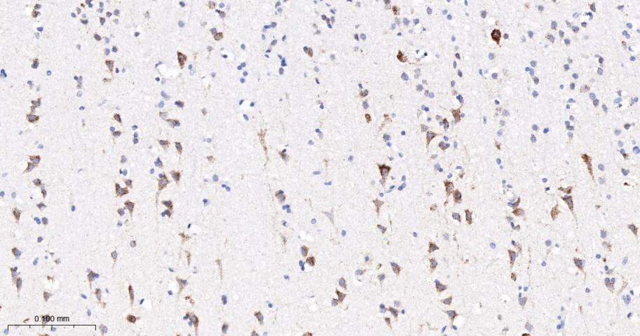 丙酮酸脱氢酶激酶亚型2重组兔单抗