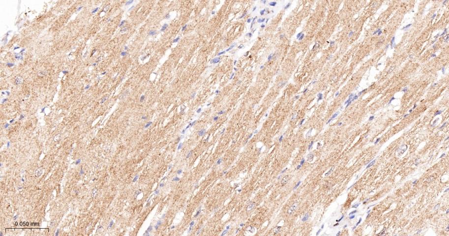 磷酸化原癌基因RAF1重组兔单抗
