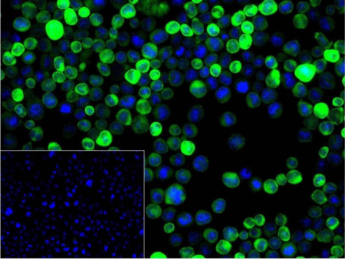 干扰素调节因子5重组兔单抗