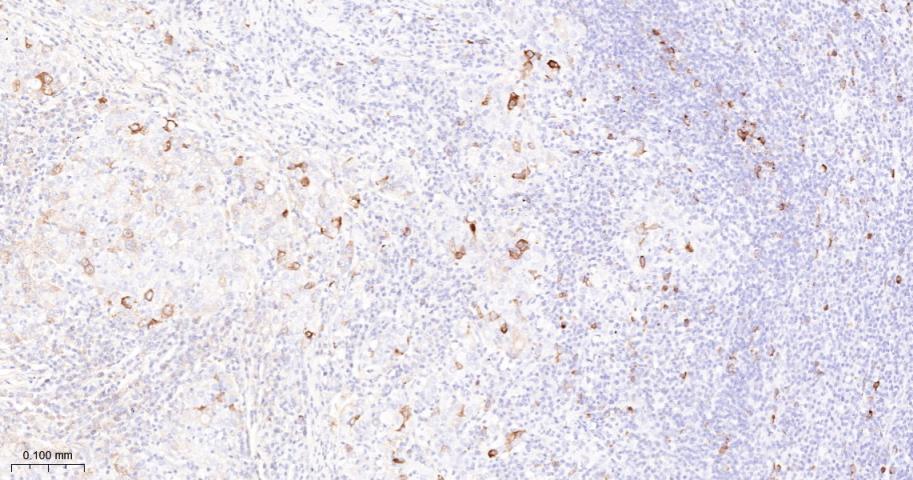 周期素B1重组兔单抗