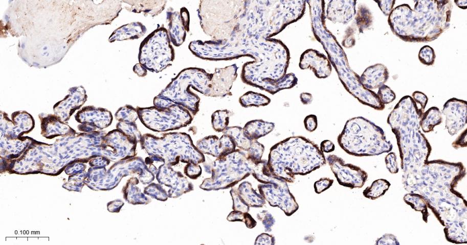 人绒毛膜促性腺激素β重组兔单抗