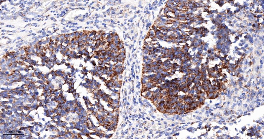 丙酮酸脱氢酶激酶亚型2重组兔单抗
