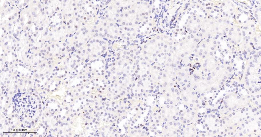 多腺苷二磷酸多聚酶/多聚ADP-核糖聚合酶1重组兔单抗