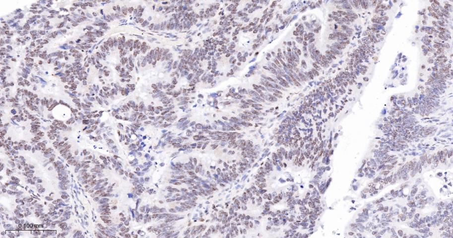 多腺苷二磷酸多聚酶/多聚ADP-核糖聚合酶1重组兔单抗