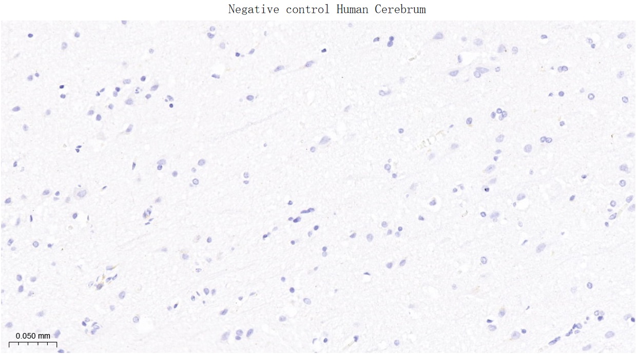 周期素B1重组兔单抗