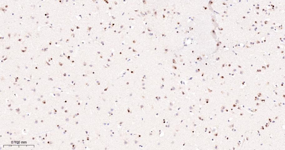 多腺苷二磷酸多聚酶/多聚ADP-核糖聚合酶1重组兔单抗