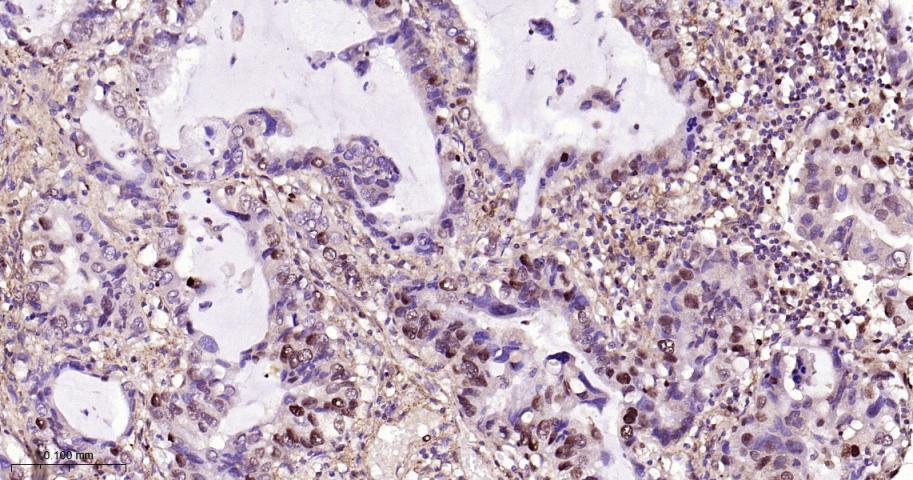 磷酸化核因子2相关因子2(Ser40)重组兔单抗