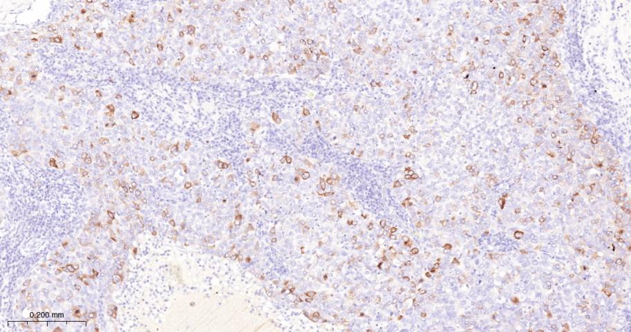 周期素B1重组兔单抗