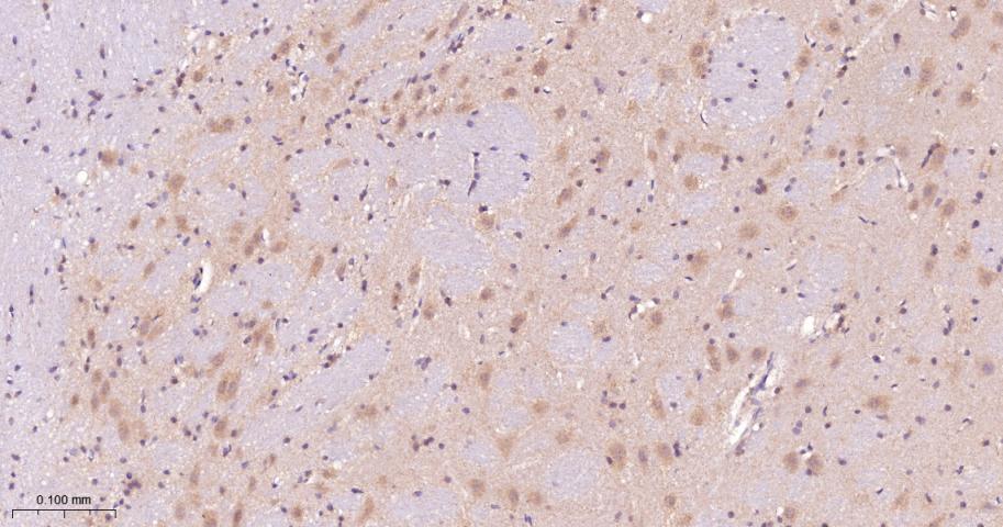 磷酸化原癌基因RAF1重组兔单抗