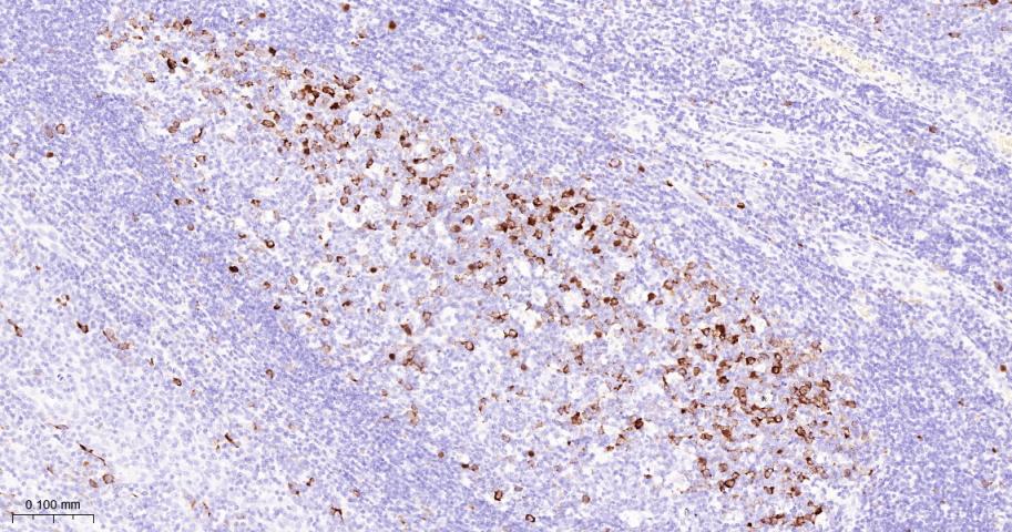 周期素B1重组兔单抗