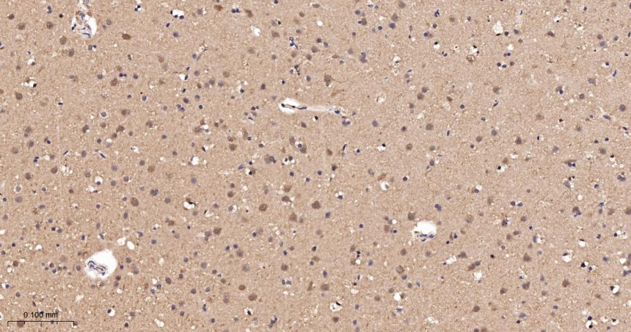 磷酯酶Cβ3重组兔单抗