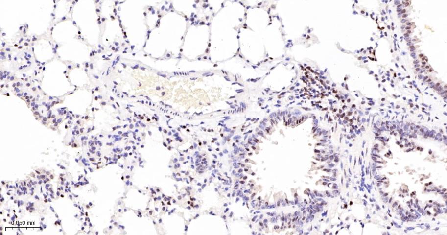 多腺苷二磷酸多聚酶/多聚ADP-核糖聚合酶1重组兔单抗