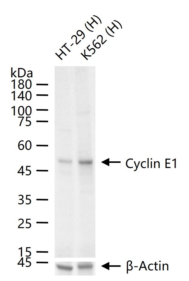 周期素E重组兔单抗