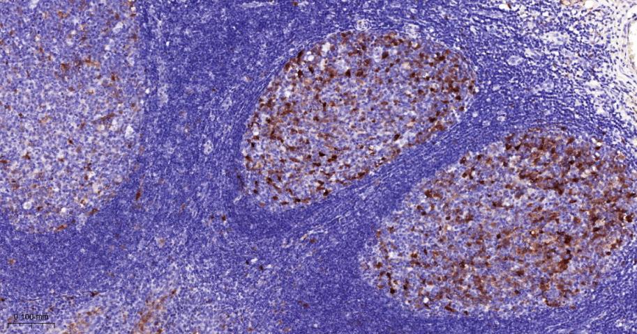 抑癌基因p16重组兔单抗