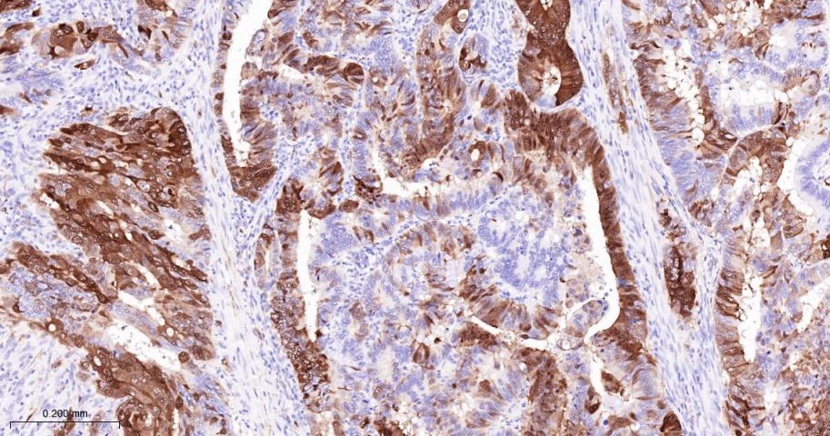 抑癌基因p16重组兔单抗