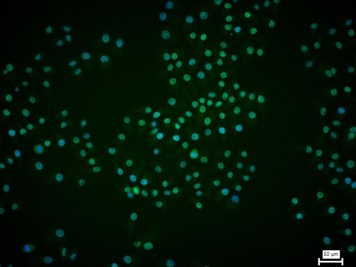 转录因子7类似物2重组兔单抗