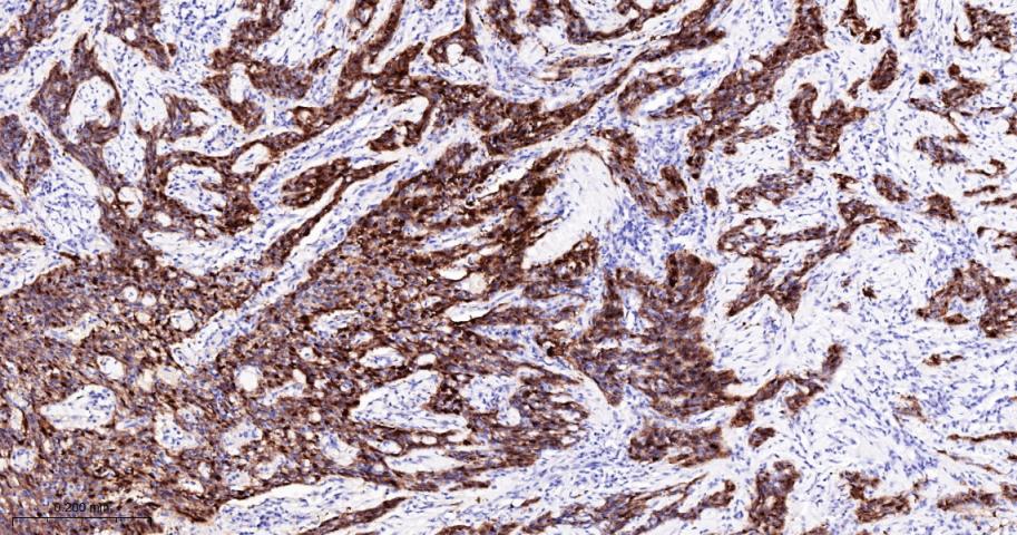 抑癌基因p16重组兔单抗