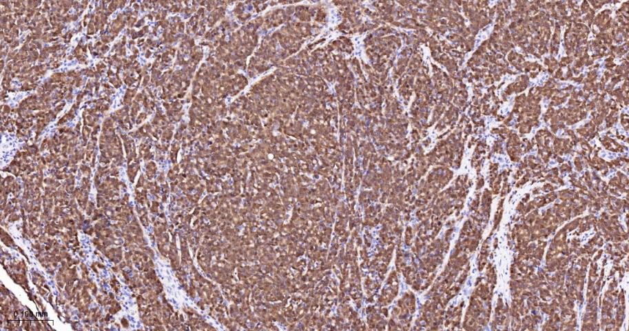 抑癌基因p16重组兔单抗
