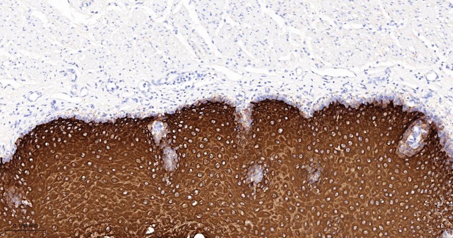 细胞角蛋白13重组兔单抗