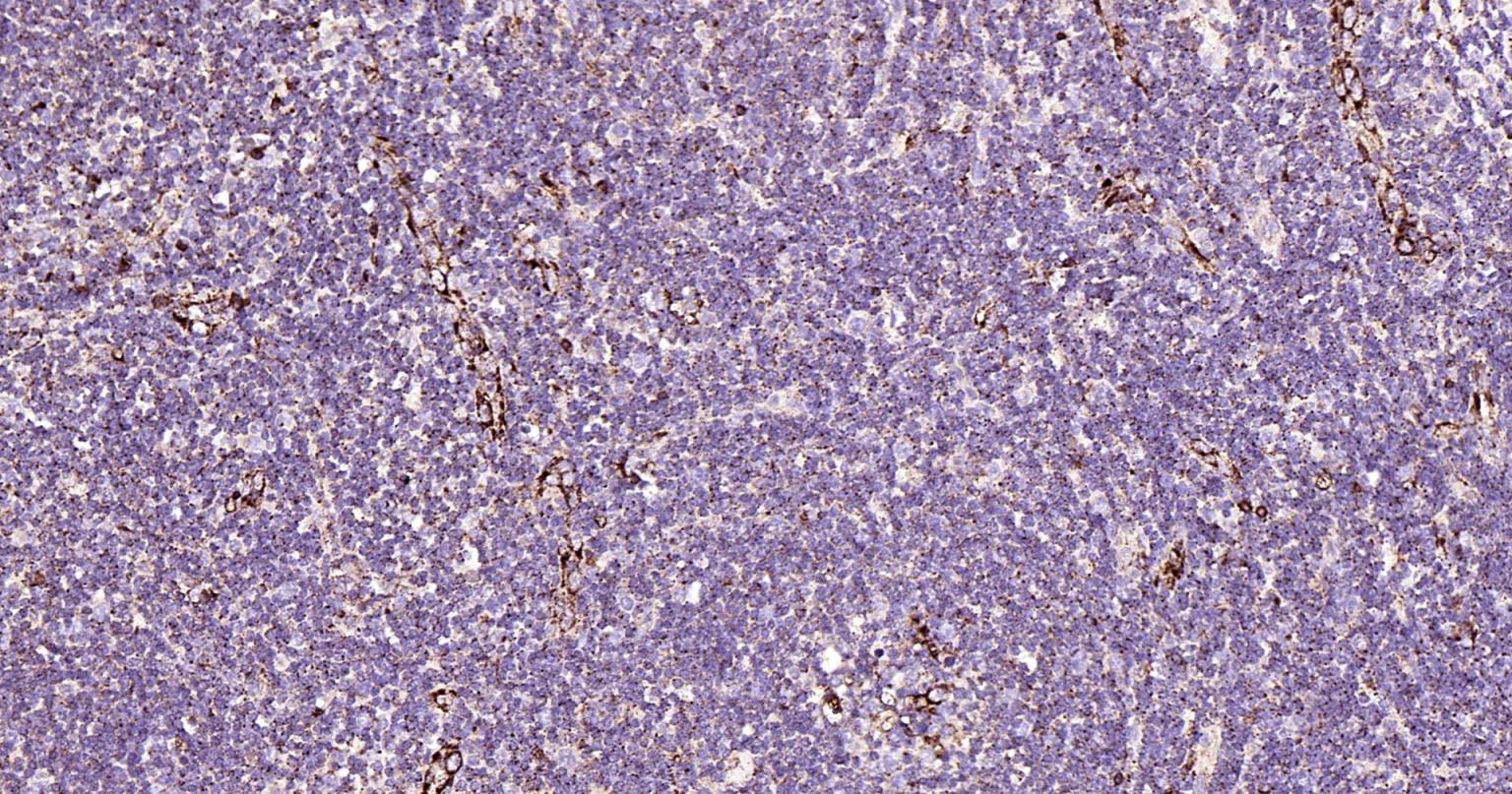 溶酶体相关膜蛋白1（CD107）单克隆抗体-bsm-51301M