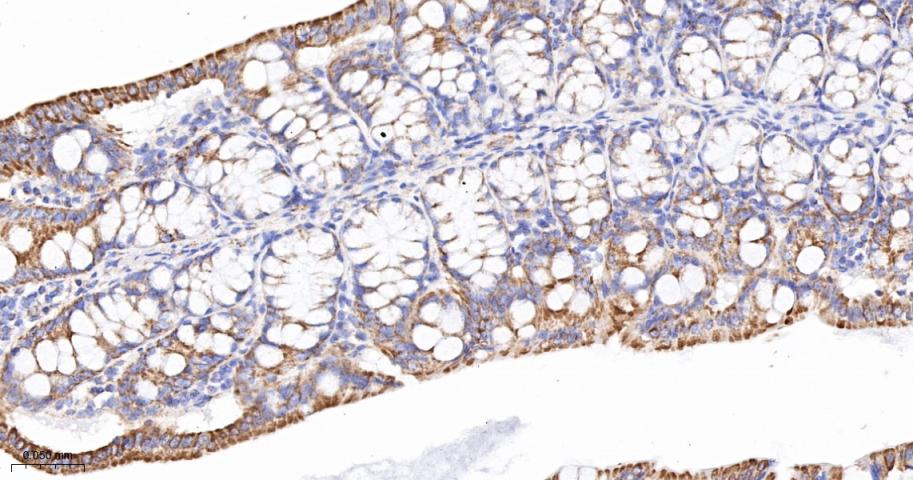 线粒体外膜受体Tom20重组兔单抗