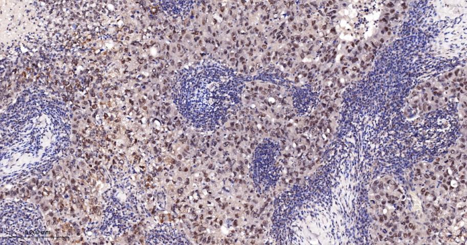 周期素E重组兔单抗