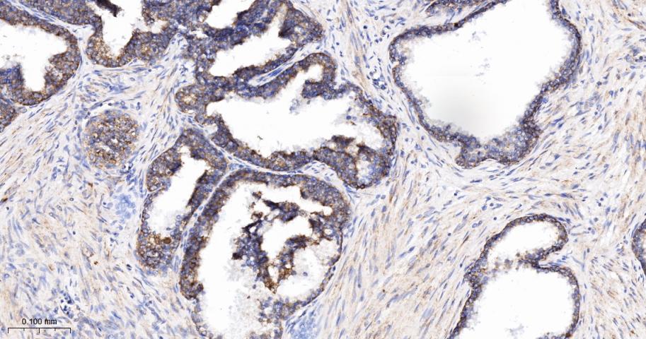 线粒体外膜受体Tom20重组兔单抗