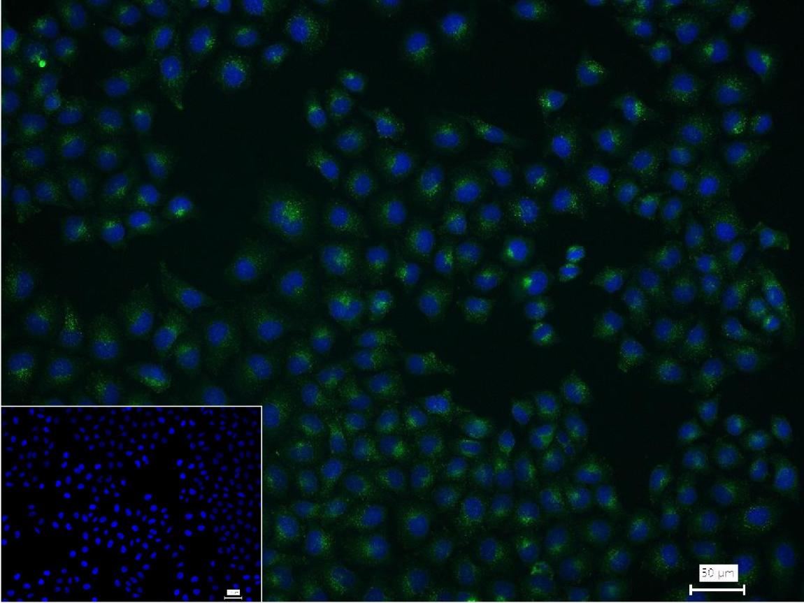 溶酶体相关膜蛋白1（CD107）单克隆抗体-bsm-51301M