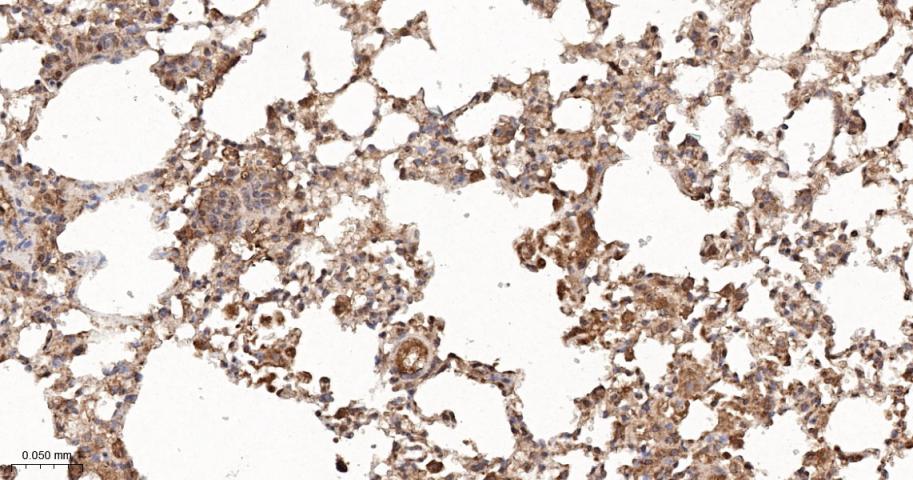 SH2结构域转化蛋白1重组兔单抗-bsm-61677R