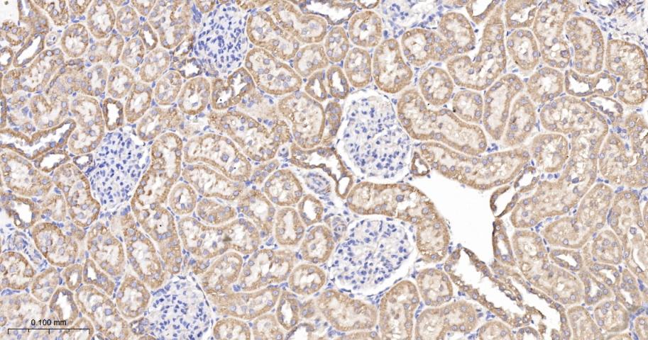 线粒体外膜受体Tom20重组兔单抗