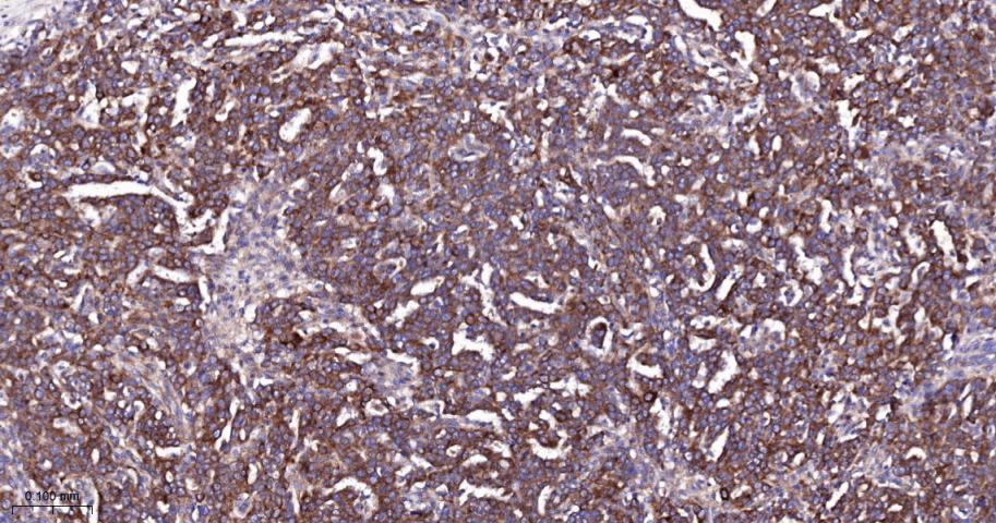 相关死亡促进因子BAD重组兔单抗